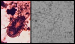 Image of microarthropod and nematode