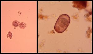 Image of a dividing ciliate and a testate amoebae